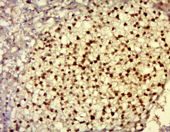 DNAJC21 Rabbit Polyclonal Antibody