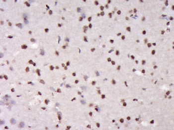 DNTTIP1 Rabbit Polyclonal Antibody