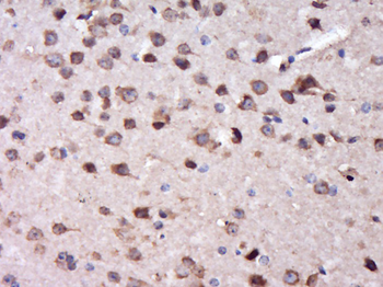 DOC2B Rabbit Polyclonal Antibody