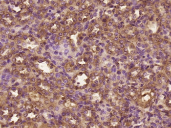 DOC2B Rabbit Polyclonal Antibody