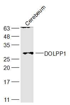 DOLPP1 Rabbit Polyclonal Antibody