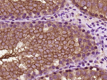 DPEP2 Rabbit Polyclonal Antibody