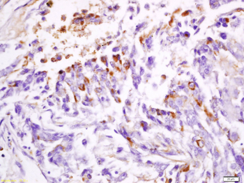 DPM1 Rabbit Polyclonal Antibody