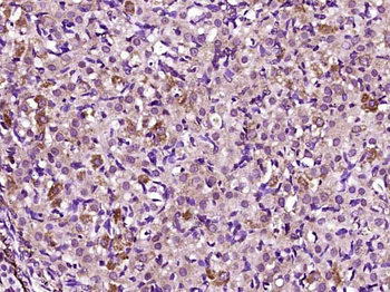 GDF9 Rabbit Polyclonal Antibody