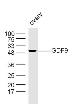 GDF9 Rabbit Polyclonal Antibody