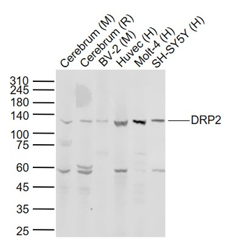 DRP2 Rabbit Polyclonal Antibody