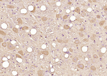 DSU Rabbit Polyclonal Antibody