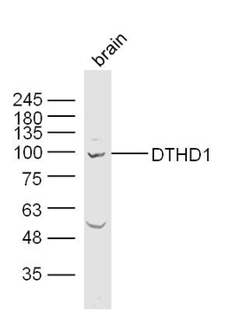 DTHD1 Rabbit Polyclonal Antibody