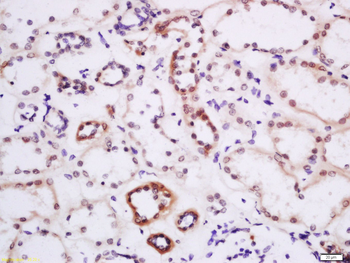 DTX3L Rabbit Polyclonal Antibody