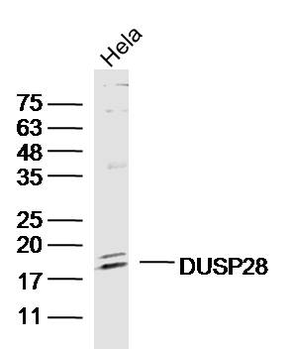 DUSP28 Rabbit Polyclonal Antibody