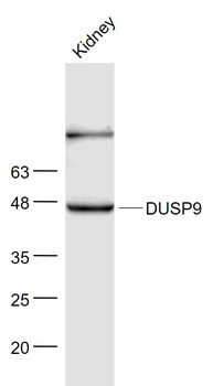 DUSP9 Rabbit Polyclonal Antibody