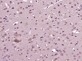 DYRK4 Rabbit Polyclonal Antibody