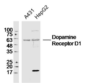 DRD1 Rabbit Polyclonal Antibody