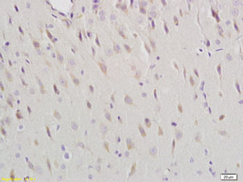 DRD1 Rabbit Polyclonal Antibody