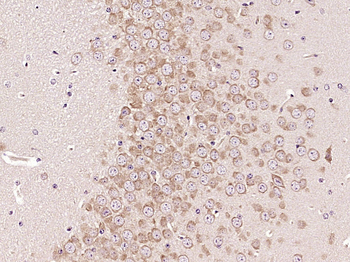 DRD1 Rabbit Polyclonal Antibody