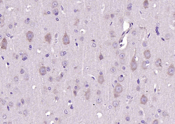 DRD1 Rabbit Polyclonal Antibody