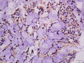EphA2 Rabbit Polyclonal Antibody