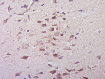 ECHDC1 Rabbit Polyclonal Antibody
