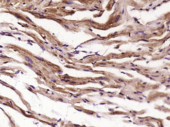 EDEM3 Rabbit Polyclonal Antibody