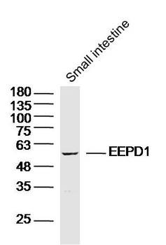 EEPD1 Rabbit Polyclonal Antibody