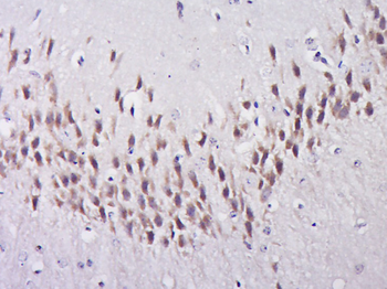 EFCAB4B Rabbit Polyclonal Antibody