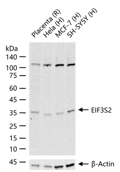EIF3S2 Rabbit Polyclonal Antibody