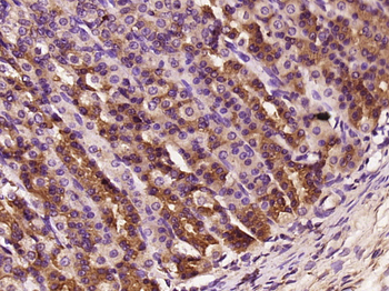 ELOVL1 Rabbit Polyclonal Antibody