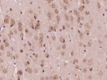 ENO4 Rabbit Polyclonal Antibody