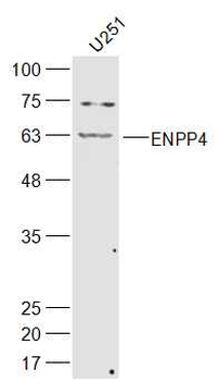 ENPP4 Rabbit Polyclonal Antibody