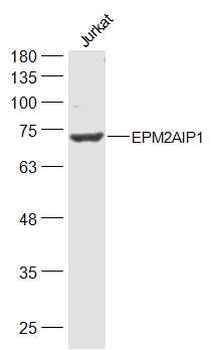 EPM2AIP1 Rabbit Polyclonal Antibody