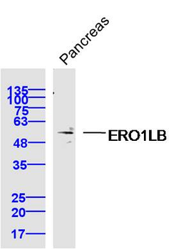 ERO1LB Rabbit Polyclonal Antibody