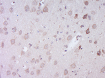 EXOC1 Rabbit Polyclonal Antibody
