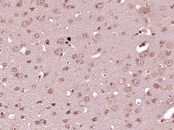 EXOC6 Rabbit Polyclonal Antibody