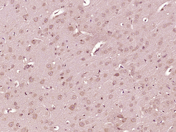 EXOC6 Rabbit Polyclonal Antibody
