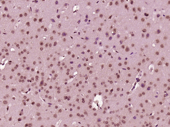 EXOSC4 Rabbit Polyclonal Antibody