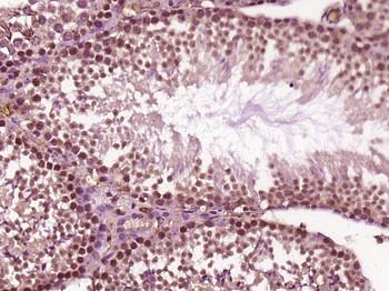 EXOSC5 Rabbit Polyclonal Antibody