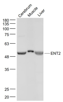 ENT2 Rabbit Polyclonal Antibody