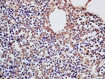 ENT2 Rabbit Polyclonal Antibody
