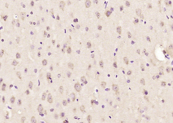FKBP1A Rabbit Polyclonal Antibody