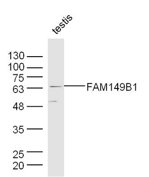 FAM149B1 Rabbit Polyclonal Antibody