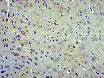 FAM160B1 Rabbit Polyclonal Antibody