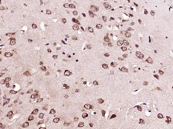 FAM167B Rabbit Polyclonal Antibody