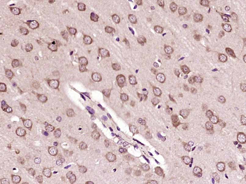 FAM167B Rabbit Polyclonal Antibody