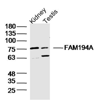 FAM194A Rabbit Polyclonal Antibody