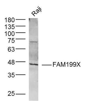 FAM199X Rabbit Polyclonal Antibody