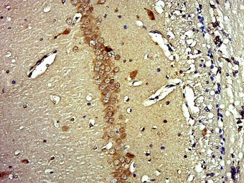 FAM43B Rabbit Polyclonal Antibody