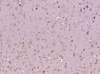 FAM83B Rabbit Polyclonal Antibody