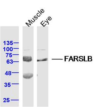 FARSLB Rabbit Polyclonal Antibody