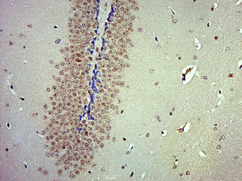 FBXO44 Rabbit Polyclonal Antibody