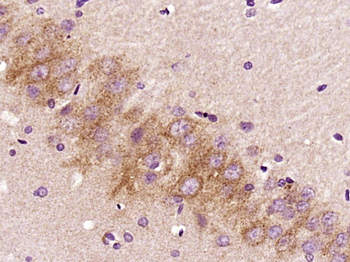 FBXO44 Rabbit Polyclonal Antibody